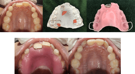 CHILD-DENTISTRY