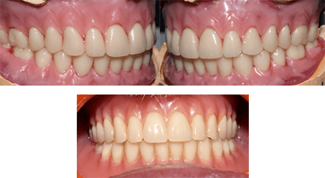 Prosthodontics